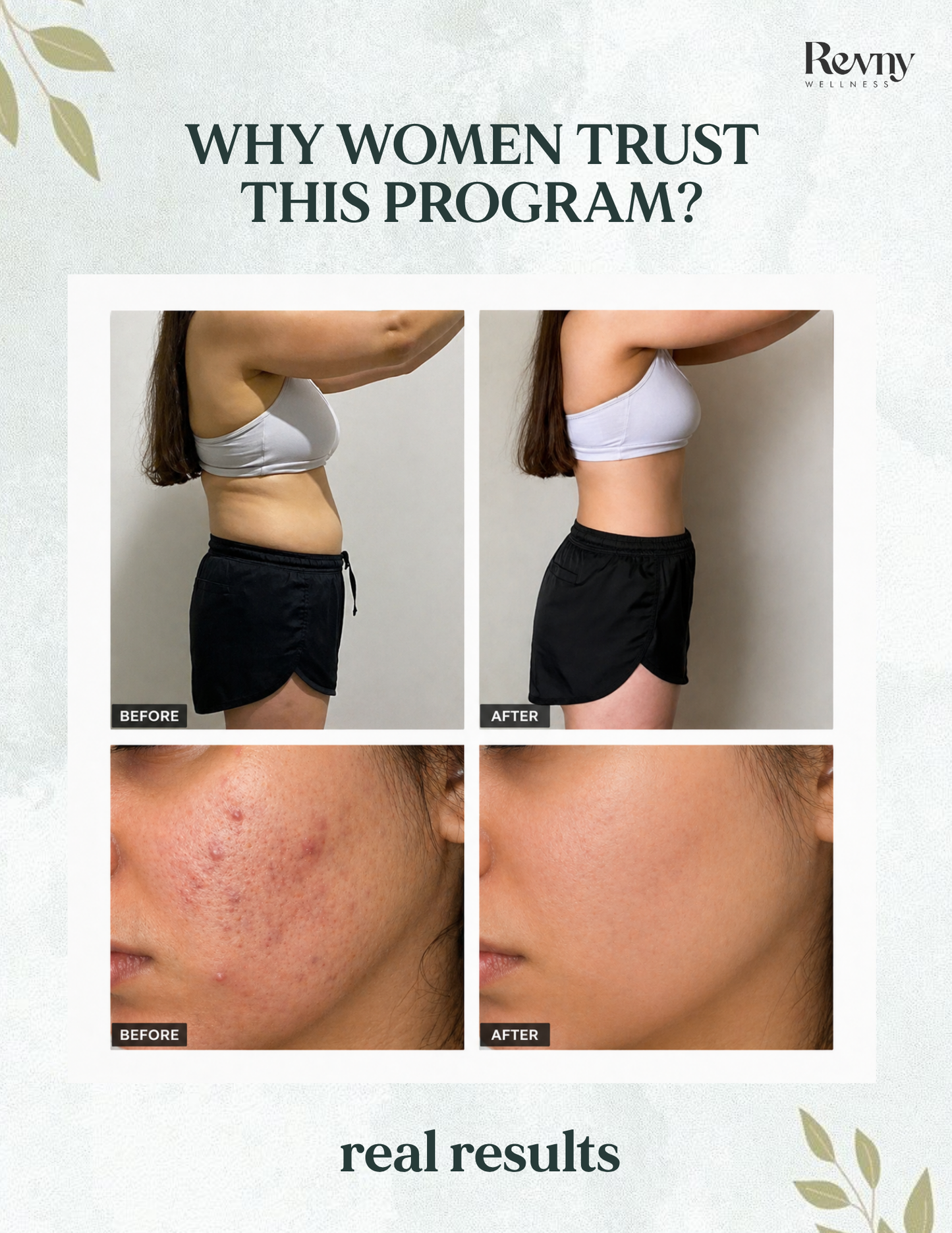 PCOS Reset Nutrition Program - 30 days